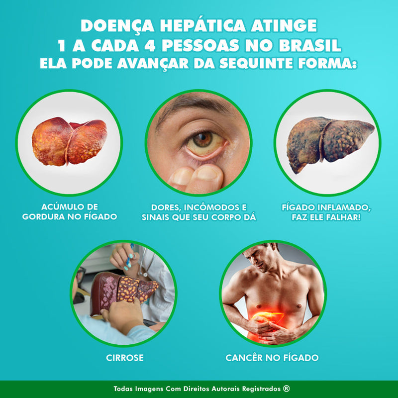 Fignar Original - Compre 1 Leve 3