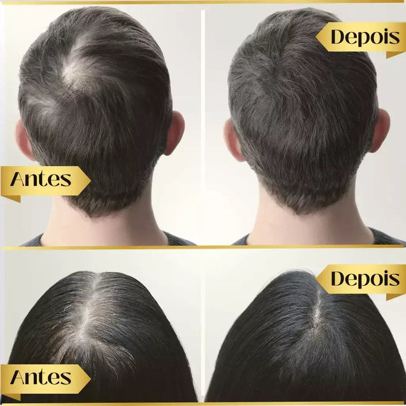 Kit 4 Repair Hair Regrowth - Compre 1 Leve 4 - Óleo de Crescimento Capilar
